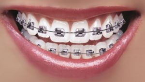 orthodontics